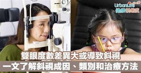 幼兒斜眼看人|斜視：成因、病徵及治療 